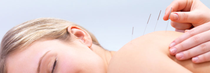 Acupuncture Arlington Heights IL FAQ's